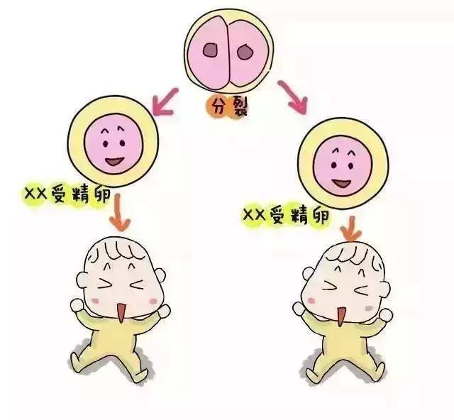 无子宫